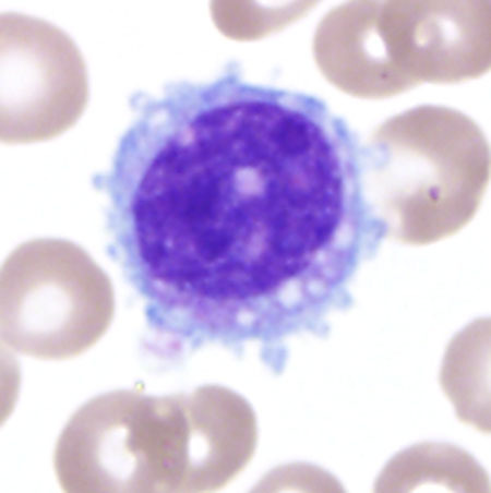 Fig 2E PB circulating micromegakaryocyte